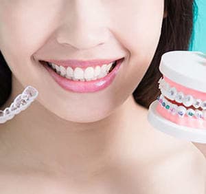 Braces / Clips in Tirupati