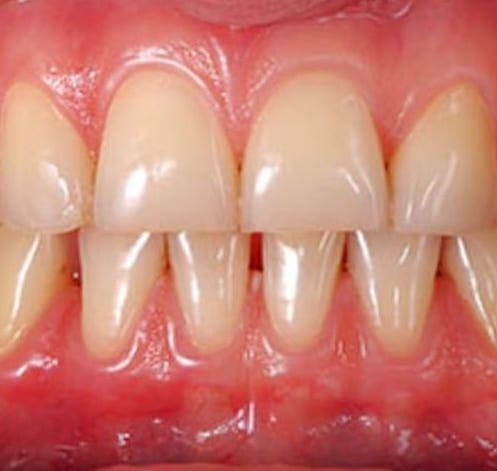 Top Dental Clinic for Gums, Scaling, Flap in Tirupathi